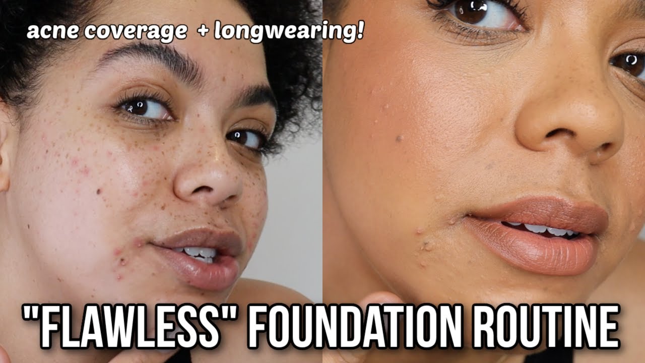 MY SKIN LOOKS TOO GOOD! Acne Foundation Routine, Longwearing + Glowy