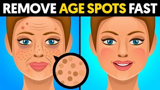 The Quickest Way To Remove Age Spots