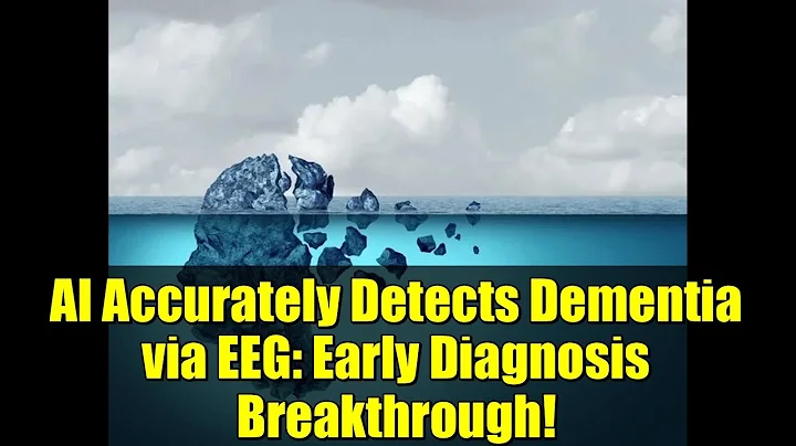 AI Accurately Detects Dementia via EEG: Early Diagnosis Breakthrough!