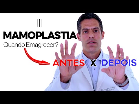 Vídeo: Devo perder peso antes da mamoplastia de aumento?