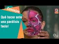 Qué hacer ante una parálisis facial | Consejos para usted