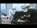Надвлагалищная ампутация матки © Supravaginal amputation of uterus