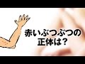 腕の赤いぶつぶつ改善法｜これって病気？【Dr.Ben*】