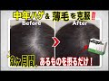 【薄毛に効く食べ物】ハゲ予防のサプリメントと“髪の材料”を完全解説｜40代からの本気対策