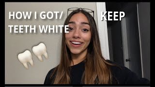 HOW I GOT MY TEETH WHITE | @GABIEKIN_