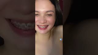 Bigo Live  Periscope Live Broadcast Vlogs