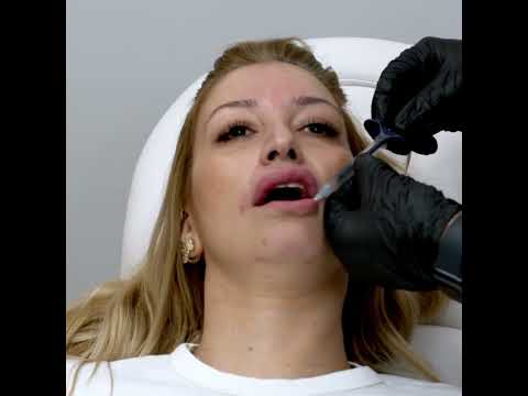 לקוחות ממליצים ב Perfecto Clinic