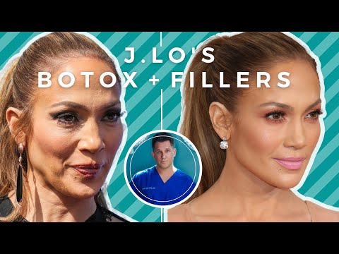 Jennifer Lopez's Botox
