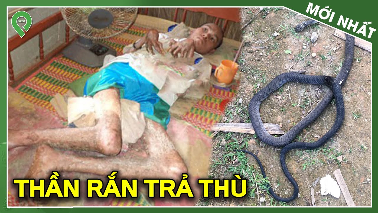 ran th  New  Cãi Lời Cha Ăn T-h-ị-t Rắn Lạ, Thanh Niên Bị Rắn Trả T-h-ù Kinh Hoàng Suốt 10 Năm