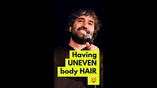 Having UNEVEN body HAIR 🧔‍♂️ | Stand up #standupcomedy #comedy #shorts