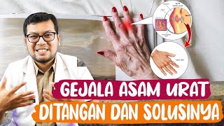 GEJALA PENYAKIT ASAM URAT DI TANGAN  DAN SOLUSINYA - DOKTER SADDAM ISMAIL