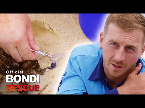 Video: Tanda-tanda Bluebottle Stings Dan Apa Yang Perlu Dilakukan