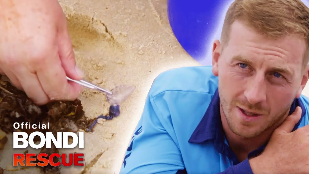 How To Treat Bluebottle Stings The Experts Advice YouTube How To Treat Bluebottle Stings The Experts Advice YouTube