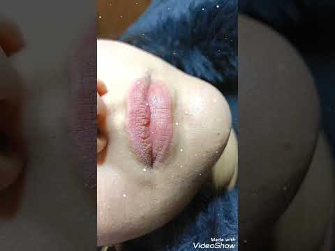 فيبر لنفخ الشفايف نتيجة روعة 0541124310