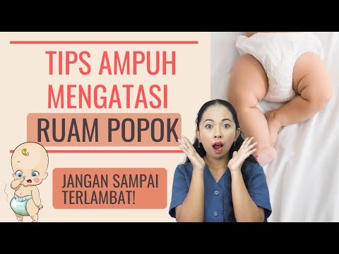 TIPS JITU ATASI DAN CEGAH RUAM POPOK!