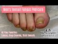 👣 Pedicure Transformation with All Your Favorites - Fungus, Deep Cleaning, Thick Toenails👣