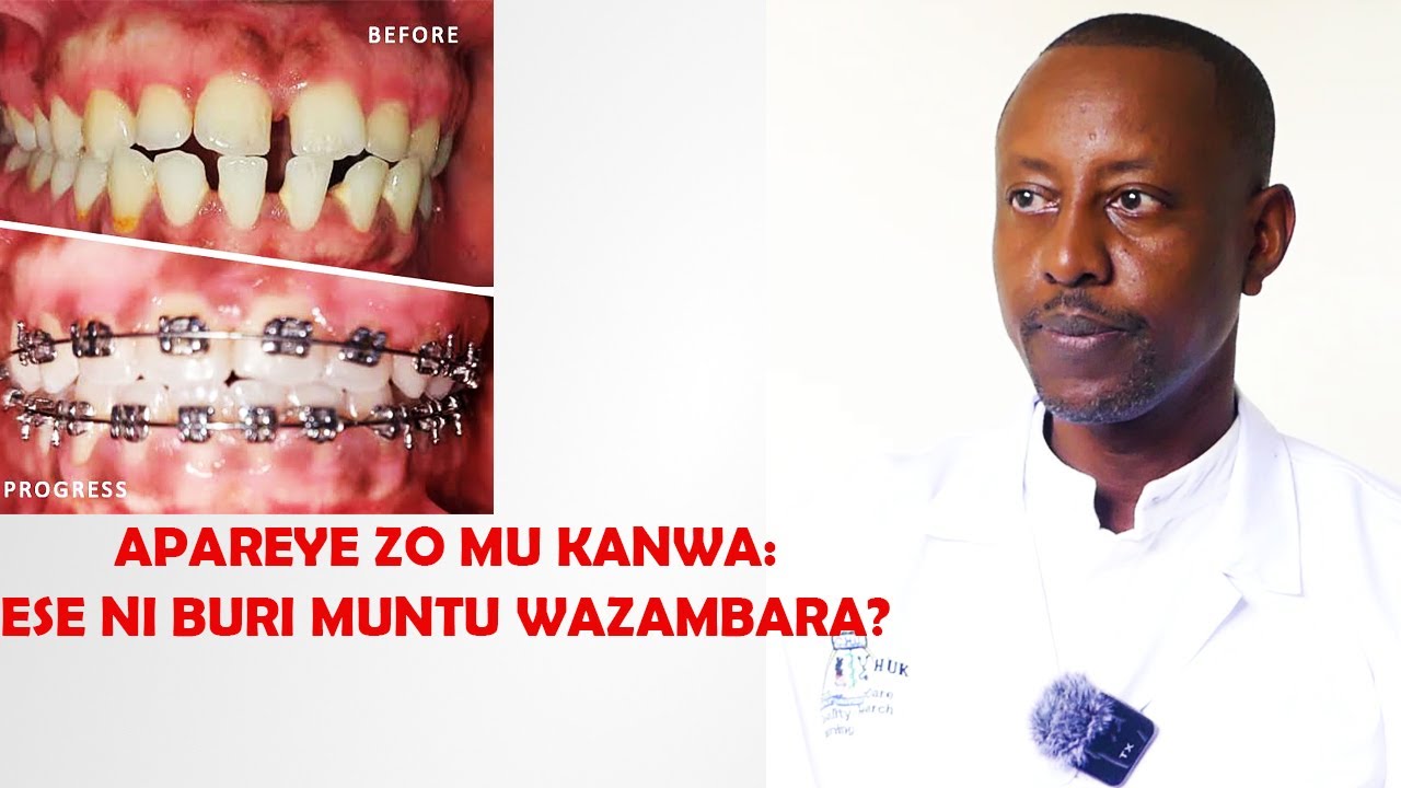 NI BANDE BEMEREWE KWAMBARA APAREYE ZO MU KANWA? MENYA UKURI KOSE