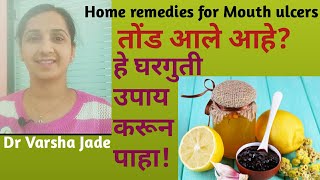 तोंड येणे घरगुती उपाय|तोंडाच्या अल्सरची कारणं आणि घरगुती उपाय|Tond yene gharguti upay|Mouth ulcers