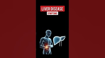 Liver disease symptoms | signs of liver failure #liverfailure #liverhealth #shorts