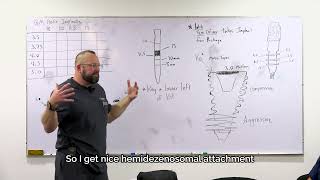 Why Neodent GM Helix for Dental Implants