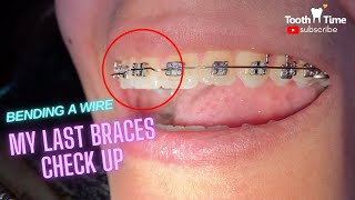 My Last Braces Checkup - Bending orthodontic wire - Tooth Time Family Dentistry New Braunfels