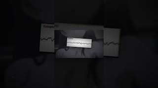 DJ HILANG HARAPAN - SOUND JJ YANG KALIAN CARI CARI!!! #shorts #djtiktokviral