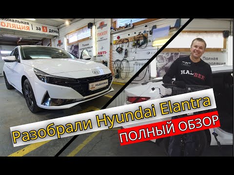 Video: Kā nomainīt Hyundai Elantra zobsiksnu?