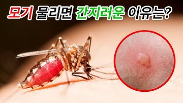 모기에 물리면 왜 가려울까? | 모기 물렸을 때 아픔 대신 