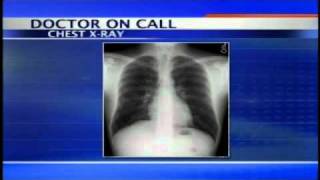 Doctor on Call 3/7/11- Chest Pains & Appendix Purpose