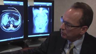 New Protocol For Ct Colonography -- Mayo Clinic