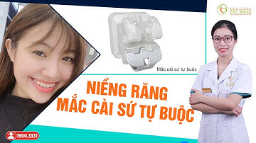 Ưu điểm của niềng răng mắc cài sứ tự buộc là gì?
