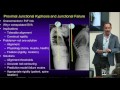 Pre-Operative Planning for Adult Spinal Deformity Surgery - Shay Bess, MD