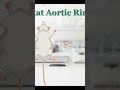 Rat Aortic Ring Assay #angiogenesis #imagej #RAR #rat #science #lab #analysis