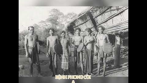 ĐỨC CHA JEAN CASSAIGNE: (P5) BỆNH PHONG CÙI