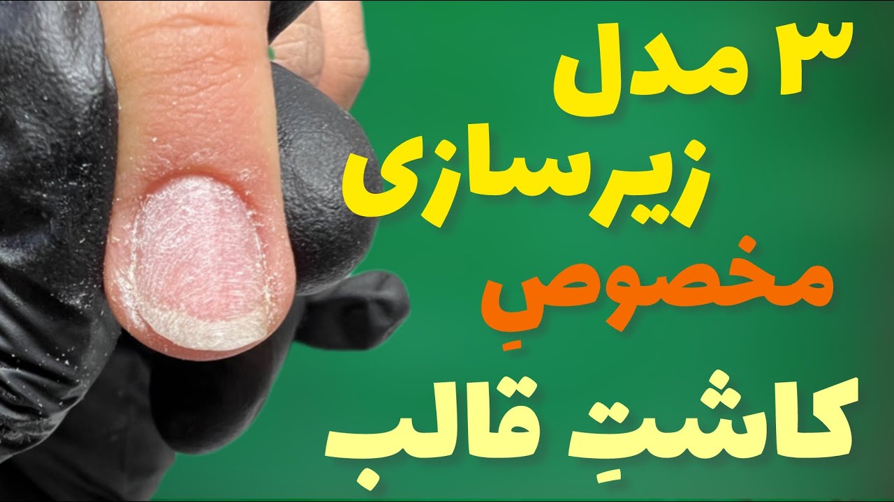 چگونه برای کاشت ناخن با قالب زیرسازی کنیم؟ (ناخن چرب را چگونه زیرسازی کنیم؟)زیرسازی مخصوص کاشت قالب