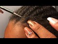 Scalp Check: Cornflakes &amp; Cornrows, Pt. 1 of 2