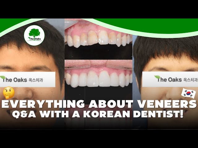 ✨ 1 Day Smile Makeover in South Korea! |  Expert Answers from Dr. Bae!