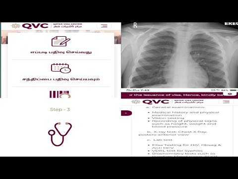 Qatar Visa Center Medical Test Report in Tamil || என்ன test எடுப்பாங்க QVC la? || QVC medical test