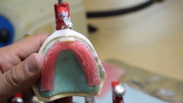 Complete denture technology 2 PRS352 ( Anterior teeth Setting)