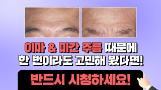 여성 주름과 다른, 남성 이마·미간 주름 CASE, 한 번이라도 신경 쓰였다면 시청하세요!