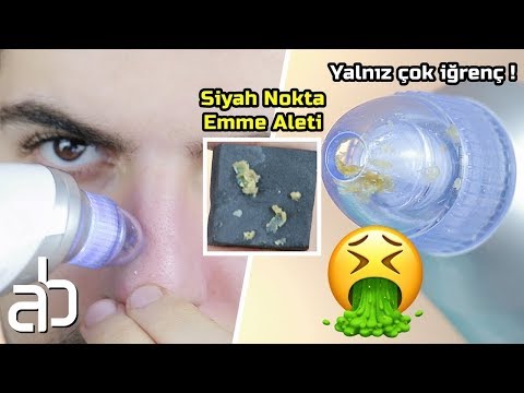 Yalnız Çok İğrenç ! SİYAH NOKTA EMME ALETİ │ Cilt Bakımı