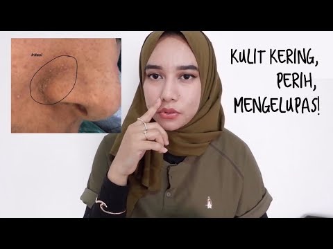 Video: 5 Cara Efektif Untuk Mengobati Hidung Kering