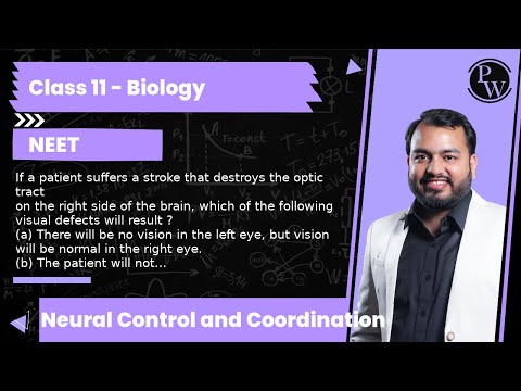 If a patient suffers a stroke that destroys the optic tract  on the...