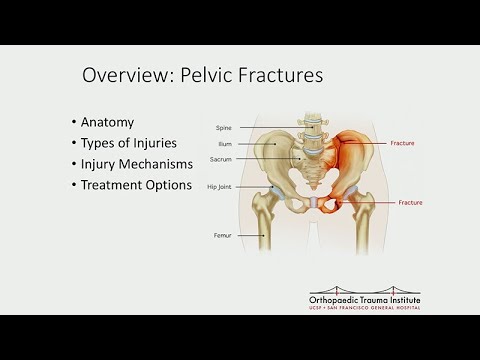 Video: Fracture Of The Ischium - Treatment, Consequences