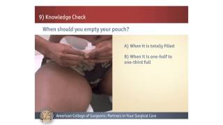 Urostomy: Knowledge Check