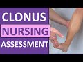 Clonus test positive reflex sign preeclampsia pregnancy  nursing skills