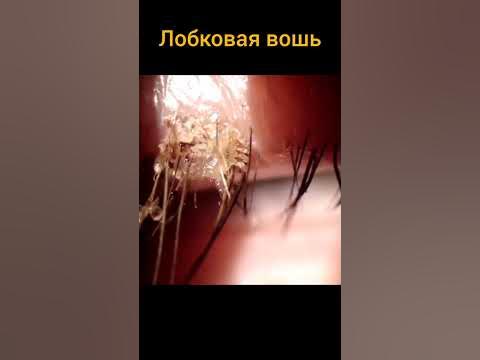 лобковая вошь #интересныефакты #факты - YouTube
