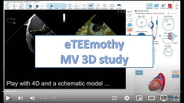 eTEEmothy Mitral Valve 3D study