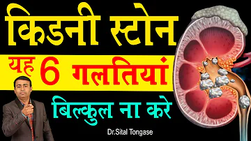 किडनी स्टोन में यह 6 गलतिया बिल्कुल ना करे I 6 mistakes in kidney stone hindi