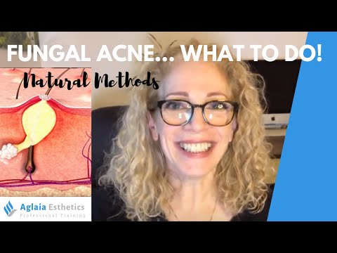 how-to-clear-fungal-acne-naturally-|-no-medication-or-nizoral